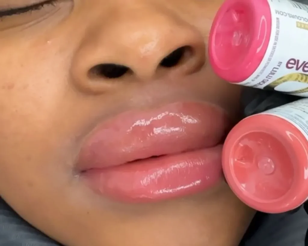 Lip Neutralization
