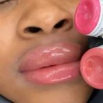 Lip Neutralization